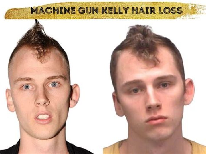 Machine Gun Kelly (Hot or Not)